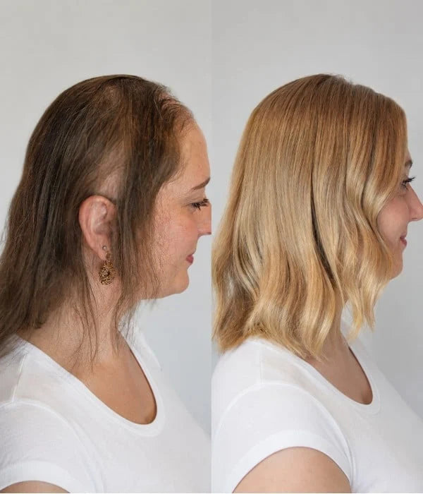 Airy Elegance Topper by Uniwigs