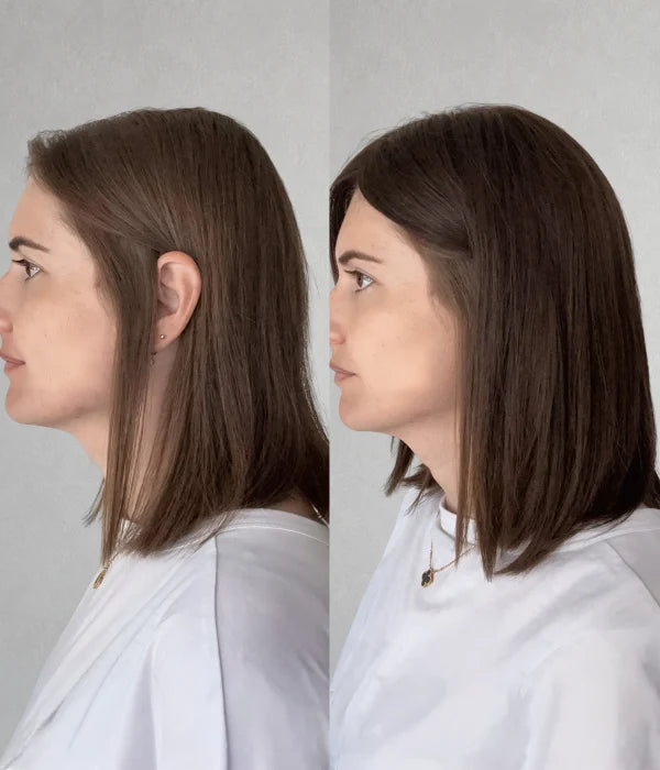 Airy Elegance Topper by Uniwigs